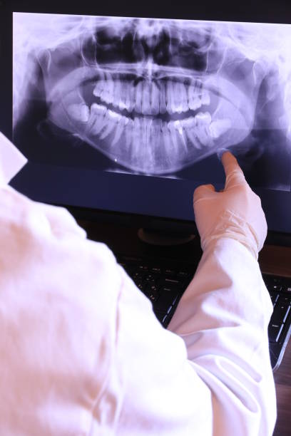 Best Emergency Wisdom Teeth Removal in Richfield, UT